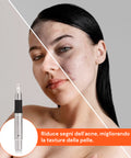 Dr. Fuchs Microneedling zur Hautregeneration und Faltenbehandlung