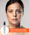 Dr. Fuchs Microneedling zur Hautregeneration und Faltenbehandlung
